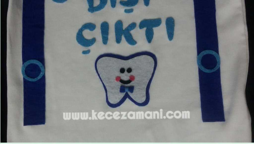 Keçe Utku’nun Dişim Çıktı Badisi Keçe Zamanı